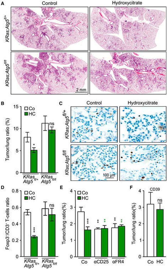 FOXP3 Antibody in Immunohistochemistry (IHC)