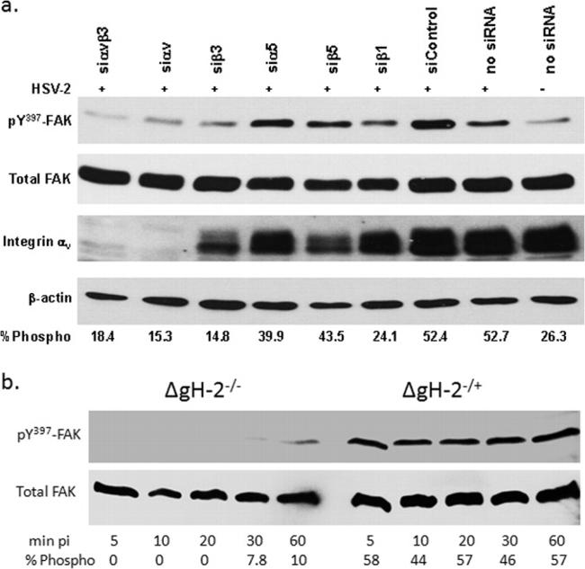 Phospho-FAK (Tyr397) Antibody in Western Blot (WB)