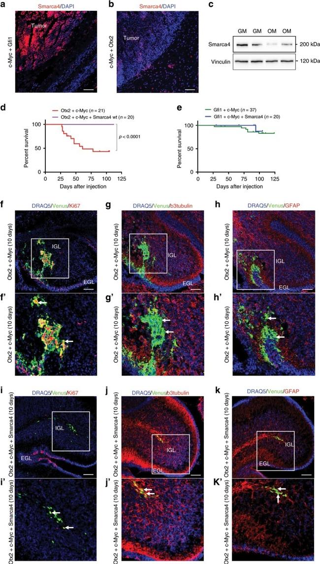 beta-3 Tubulin Antibody in Immunohistochemistry (IHC)