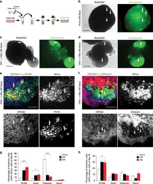 beta-3 Tubulin Antibody in Immunohistochemistry (IHC)