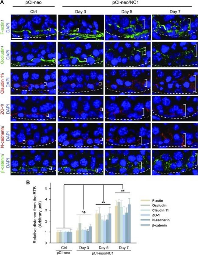 beta Catenin Antibody in Immunohistochemistry (IHC)