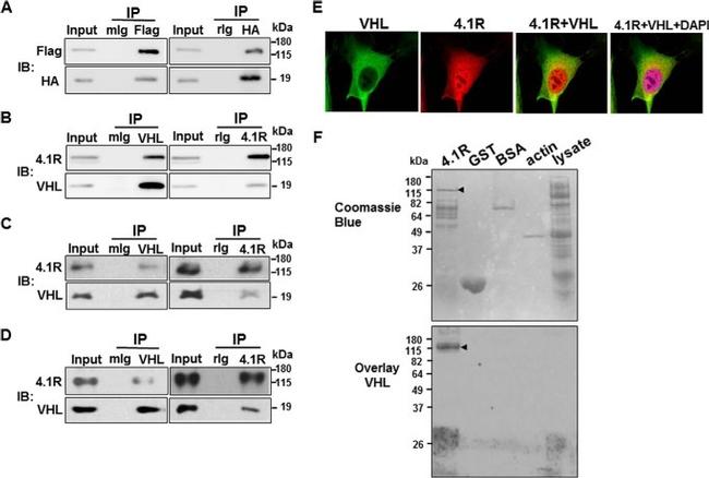 6x-His Tag Antibody in Western Blot (WB)