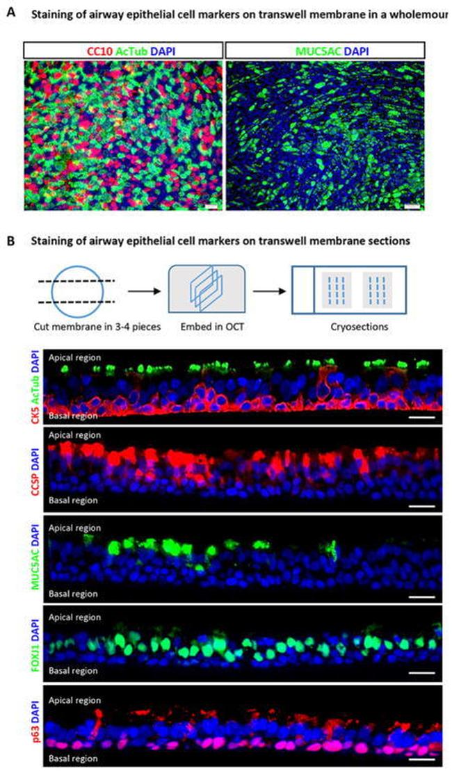 FOXJ1 Antibody in Immunocytochemistry (ICC/IF)