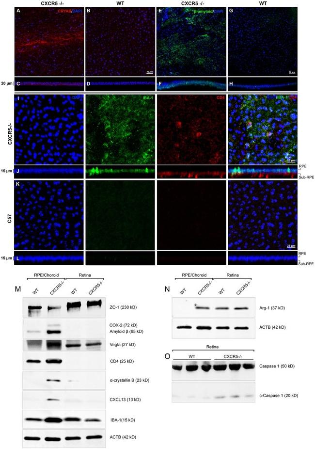 beta Amyloid Antibody in Western Blot, Immunohistochemistry (WB, IHC)