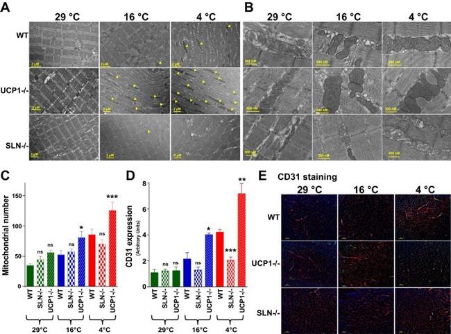 Laminin Antibody in Immunohistochemistry (IHC)