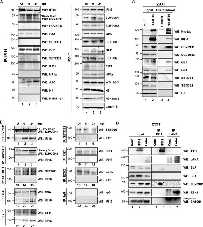 6x-His Tag Antibody in Western Blot (WB)