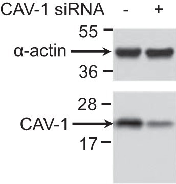 Caveolin 1 Antibody in Western Blot (WB)