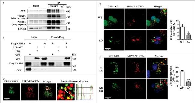 beta Amyloid Antibody in Immunocytochemistry (ICC/IF)