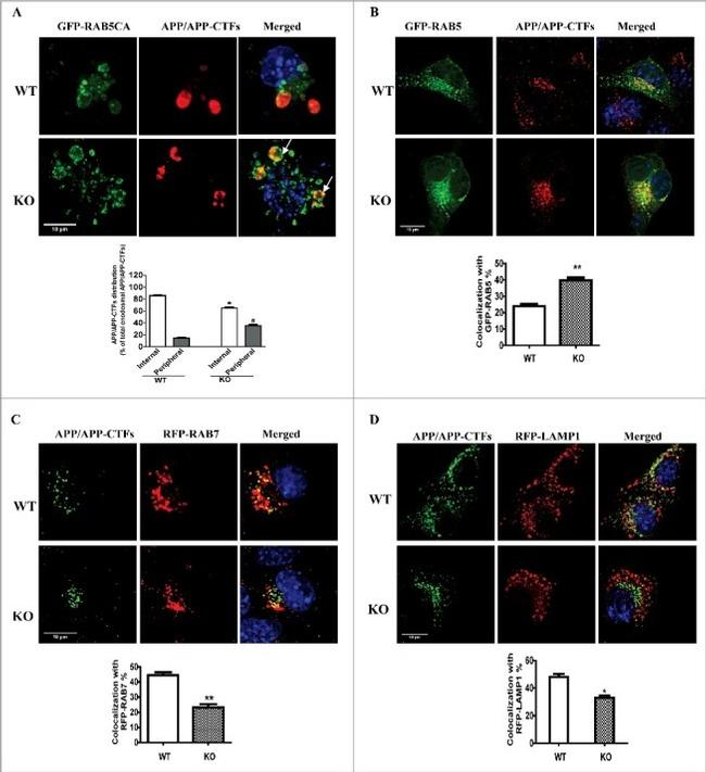 beta Amyloid Antibody in Immunocytochemistry (ICC/IF)