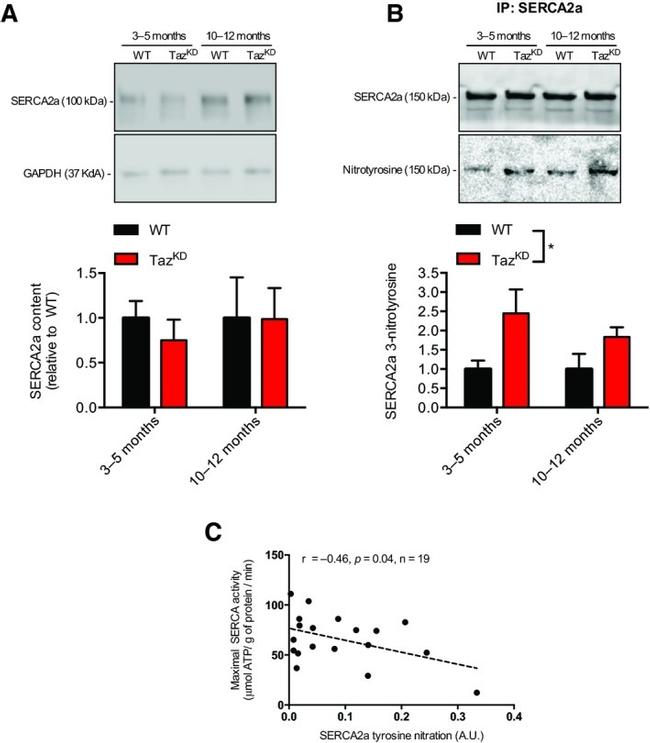 SERCA2 ATPase Antibody in Western Blot (WB)