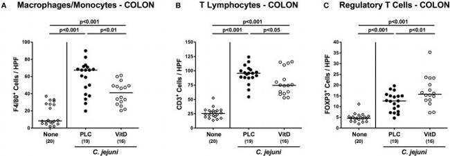 FOXP3 Antibody in Immunohistochemistry (IHC)