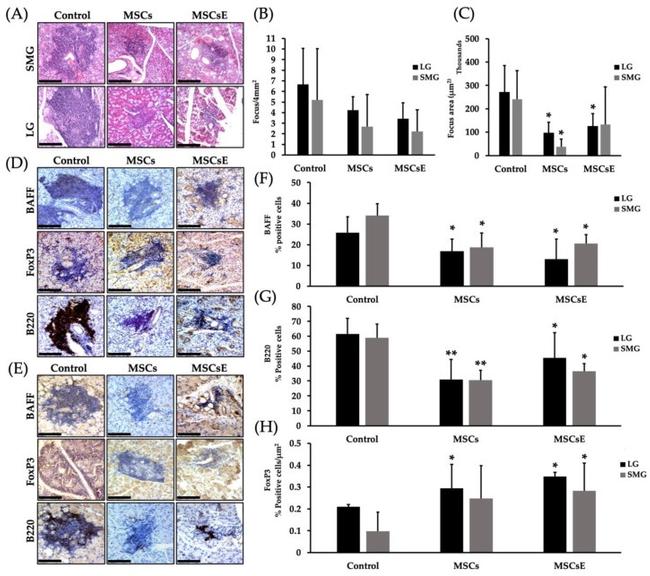 FOXP3 Antibody in Immunohistochemistry (IHC)