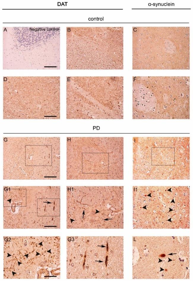 alpha Synuclein Antibody in Immunohistochemistry (IHC)