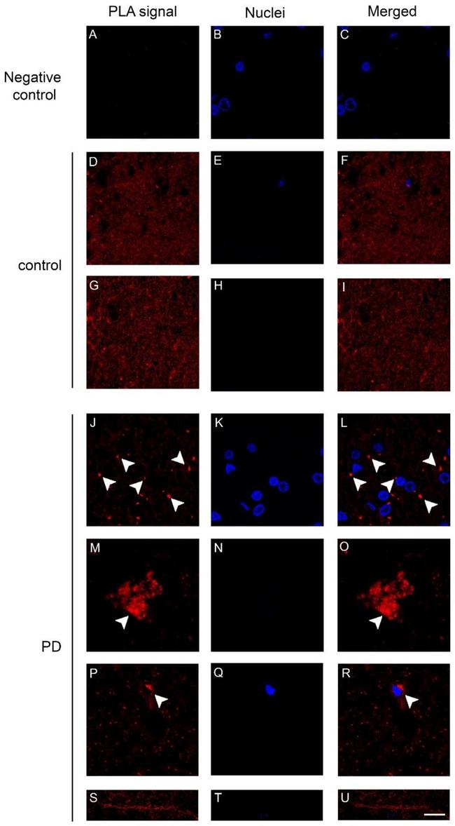 alpha Synuclein Antibody in Proximity Ligation Assay (PLA) (PLA)