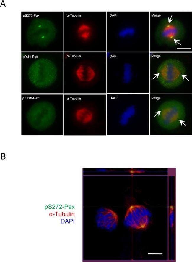 Phospho-Paxillin (Tyr118) Antibody in Immunocytochemistry (ICC/IF)