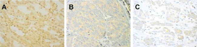 CD152 (CTLA-4) Antibody in Immunohistochemistry (IHC)