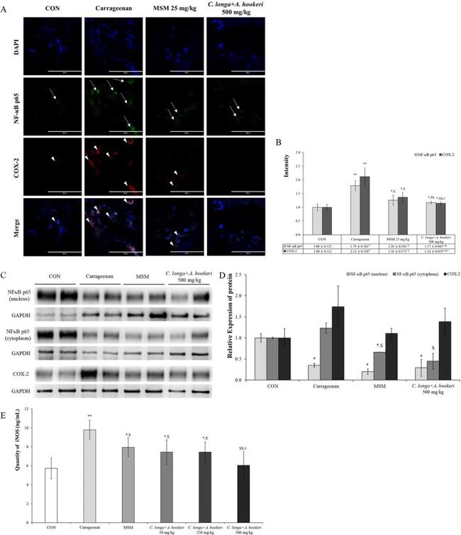 NFkB p65 Antibody in Western Blot, Immunocytochemistry, Immunohistochemistry (WB, ICC/IF, IHC)