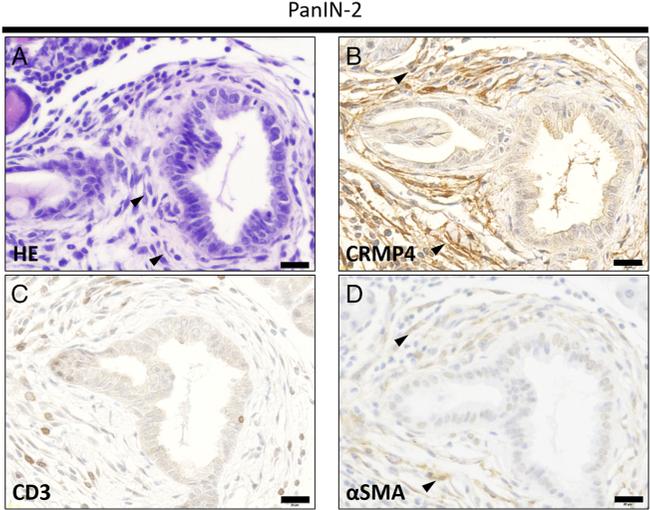 Alpha-Smooth Muscle Actin Antibody in Immunohistochemistry (IHC)