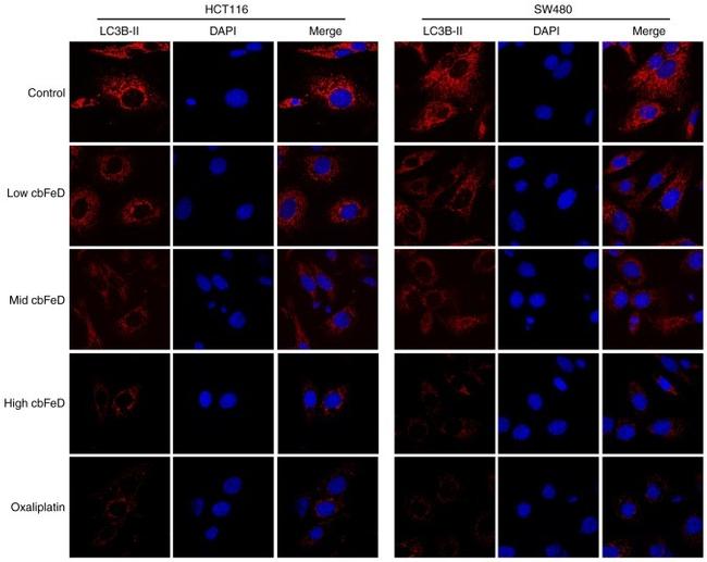 LC3B Antibody in Immunocytochemistry (ICC/IF)