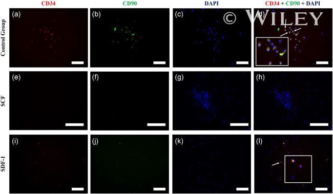 CD90 (Thy-1) Antibody in Immunocytochemistry (ICC/IF)