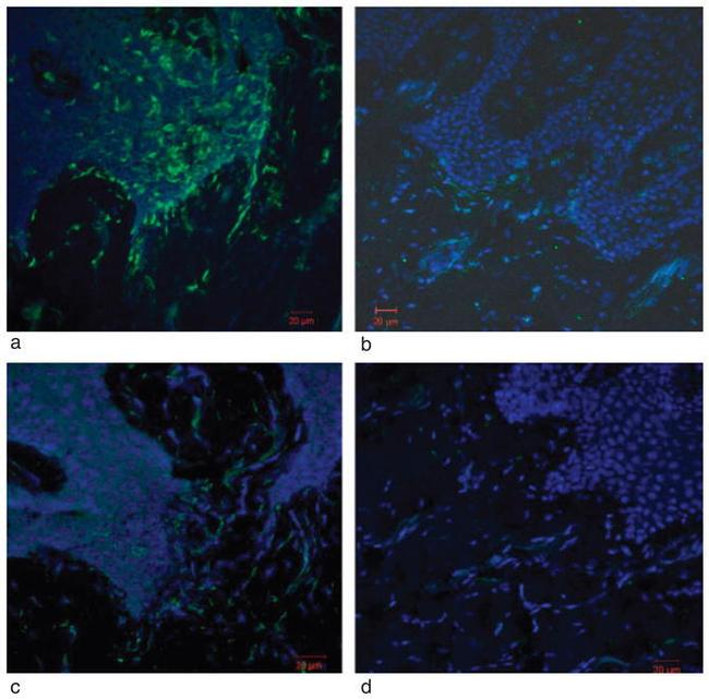 CD56 (NCAM) Antibody in Immunohistochemistry (IHC)