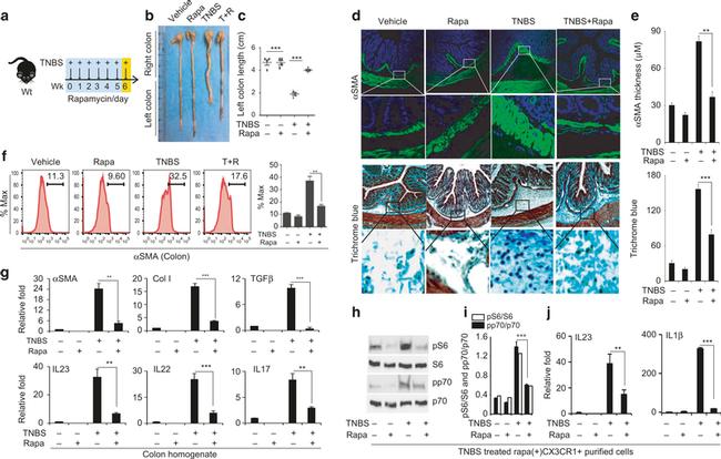 Alpha-Smooth Muscle Actin Antibody in Immunocytochemistry (ICC/IF)