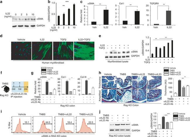 Alpha-Smooth Muscle Actin Antibody in Immunocytochemistry (ICC/IF)