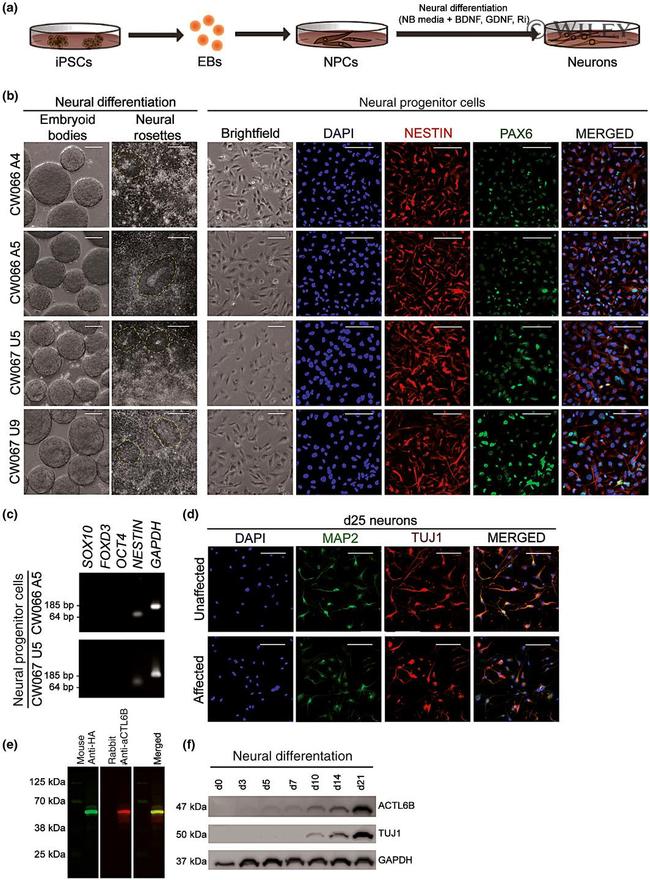 Nestin Antibody in Immunocytochemistry (ICC/IF)