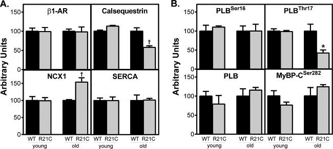 SERCA2 ATPase Antibody in Western Blot (WB)