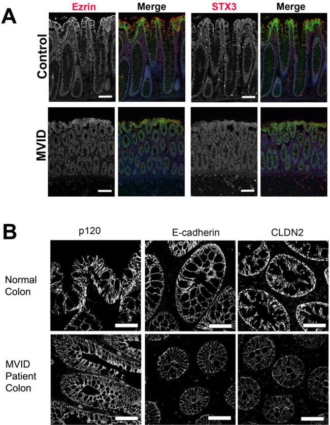 Claudin 2 Antibody in Immunohistochemistry (IHC)