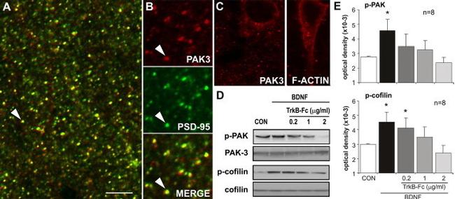 Phospho-PAK1/2/3 (Ser141) Antibody in Western Blot (WB)