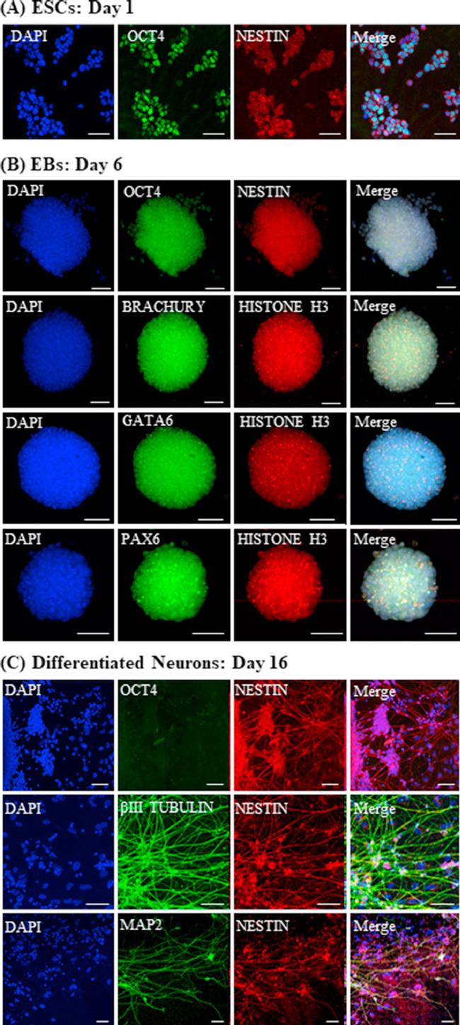 Nestin Antibody in Immunocytochemistry (ICC/IF)