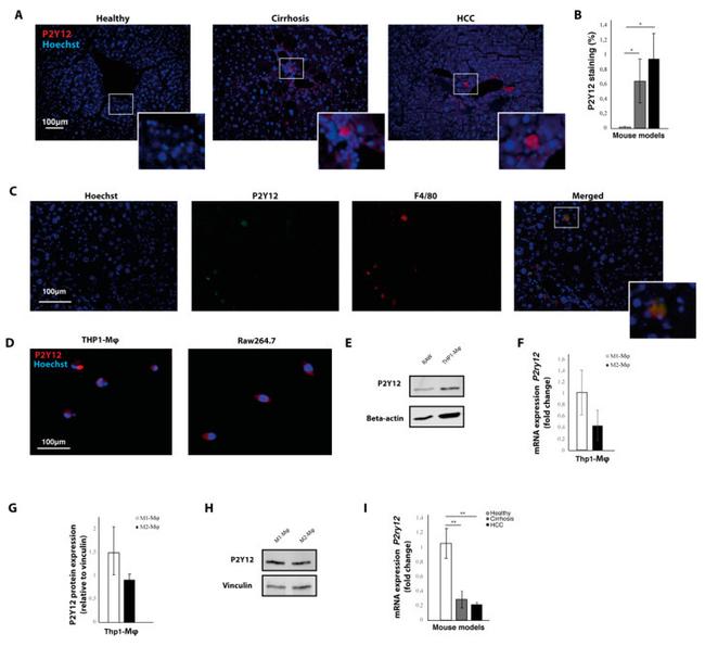 F4/80 Antibody in Immunohistochemistry (IHC)