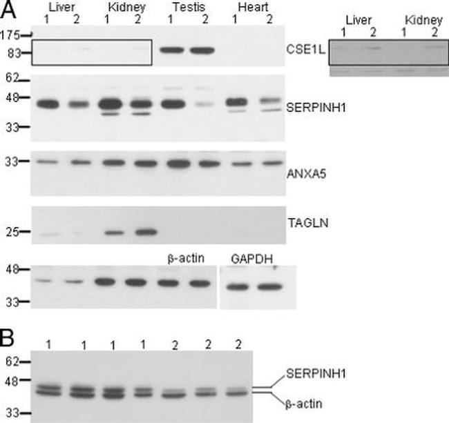 GAPDH Antibody in Western Blot (WB)